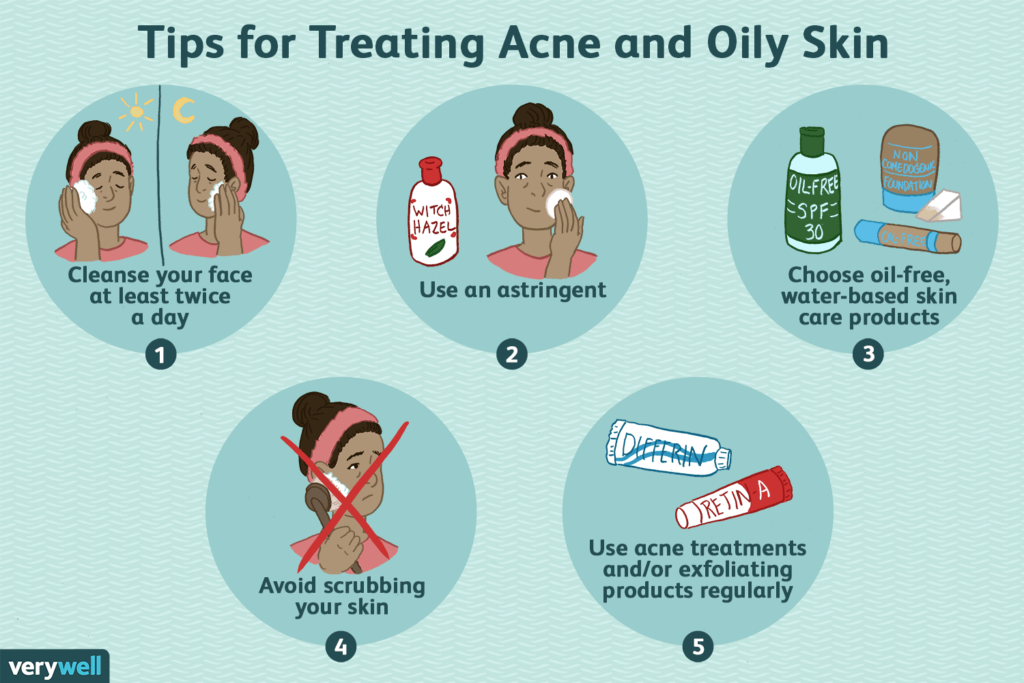 How To Treat And Prevent Acne